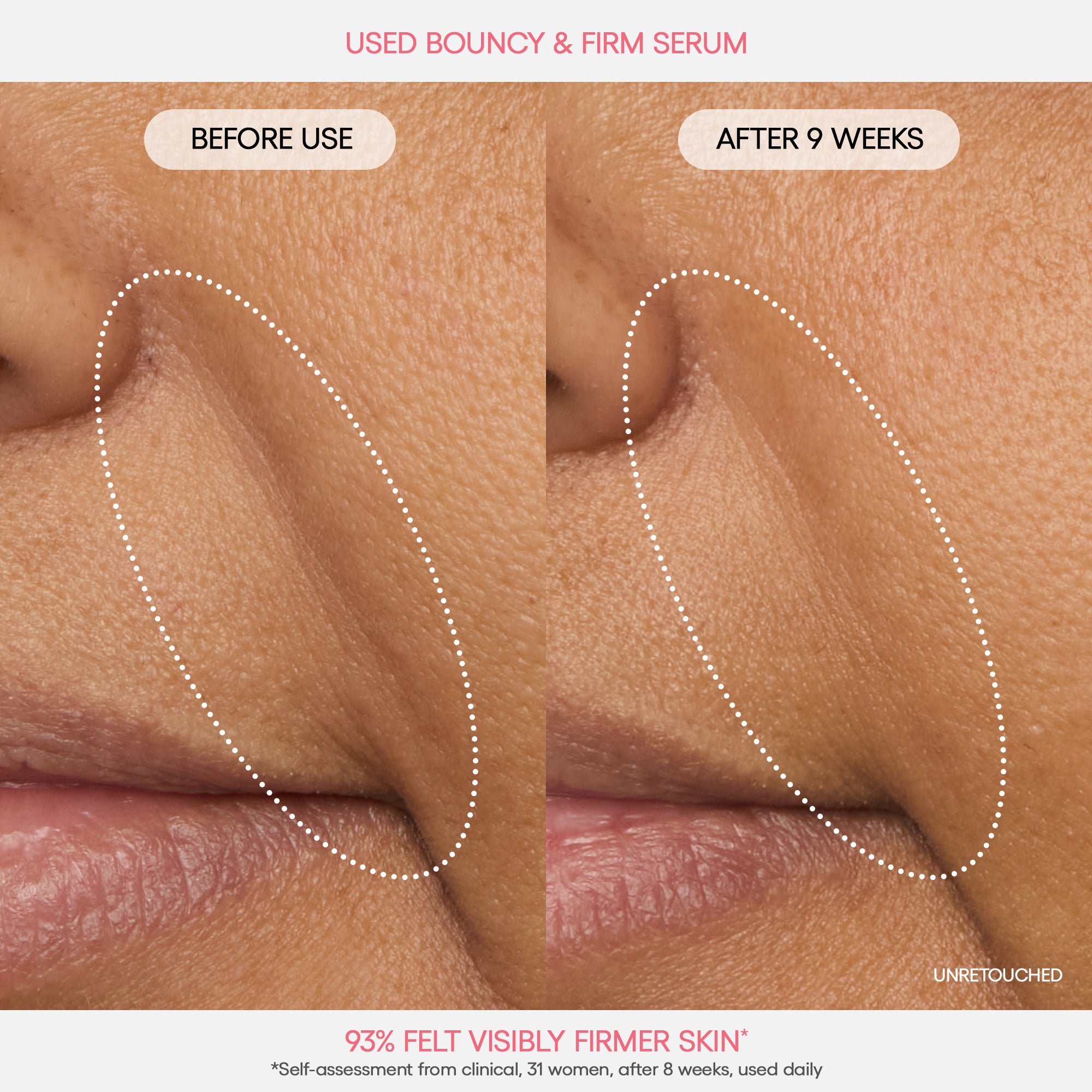 Alternative view of Free Bouncy & Firm Serum